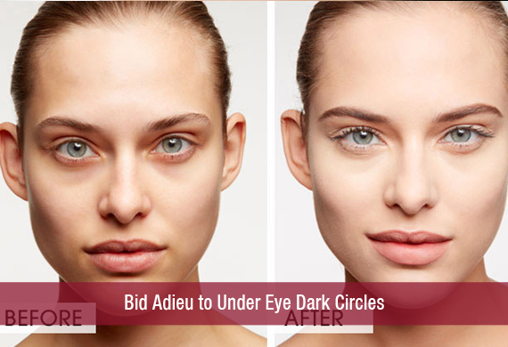 Bid Adieu to Under Eye Dark Circles