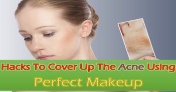 10 Genius Hacks To Cover Up The Acne Using Perfect Makeup
