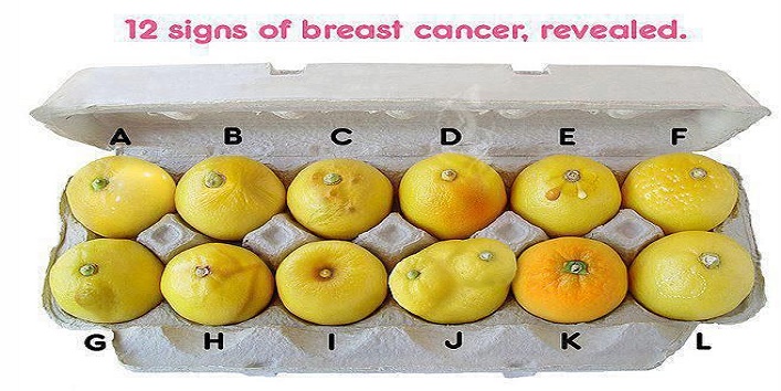 signs-of-breast-cancer4