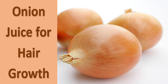 Check out the Ways to Use Onion Juice for Hair ...
